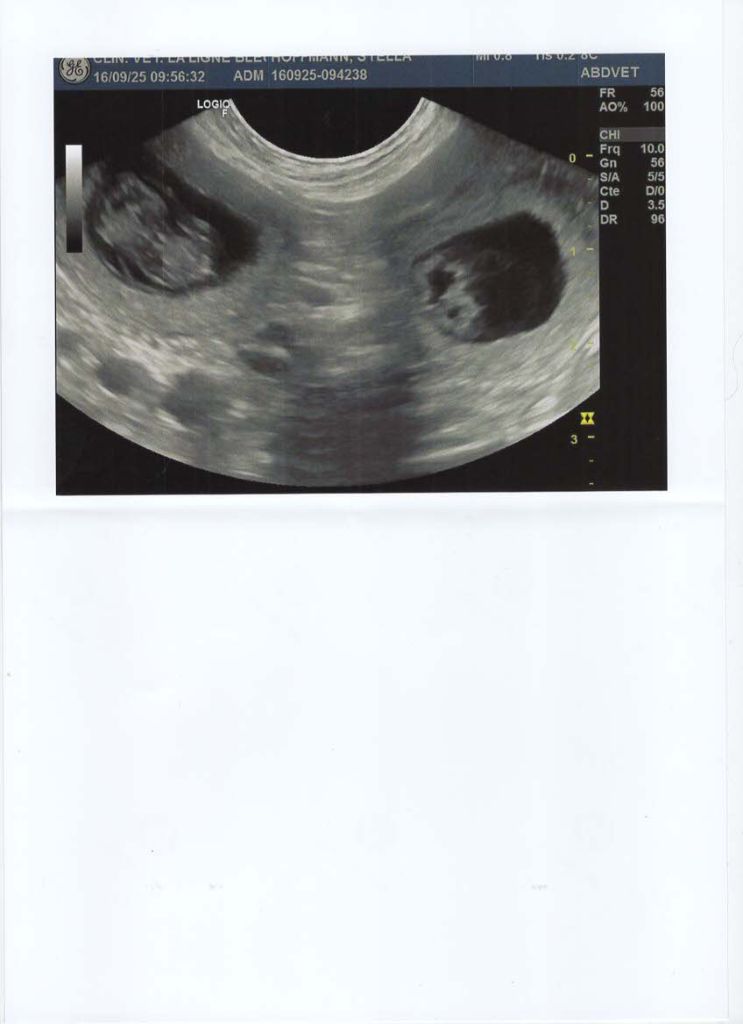 Gestation